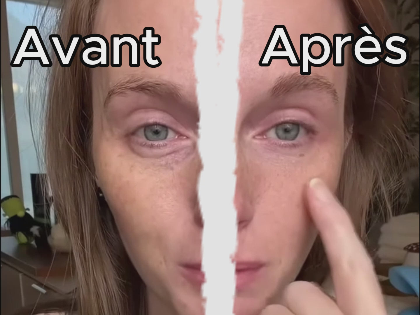 LYMORA | فرشاة مساج للوجه لتنشيط الدورة اللمفاوية